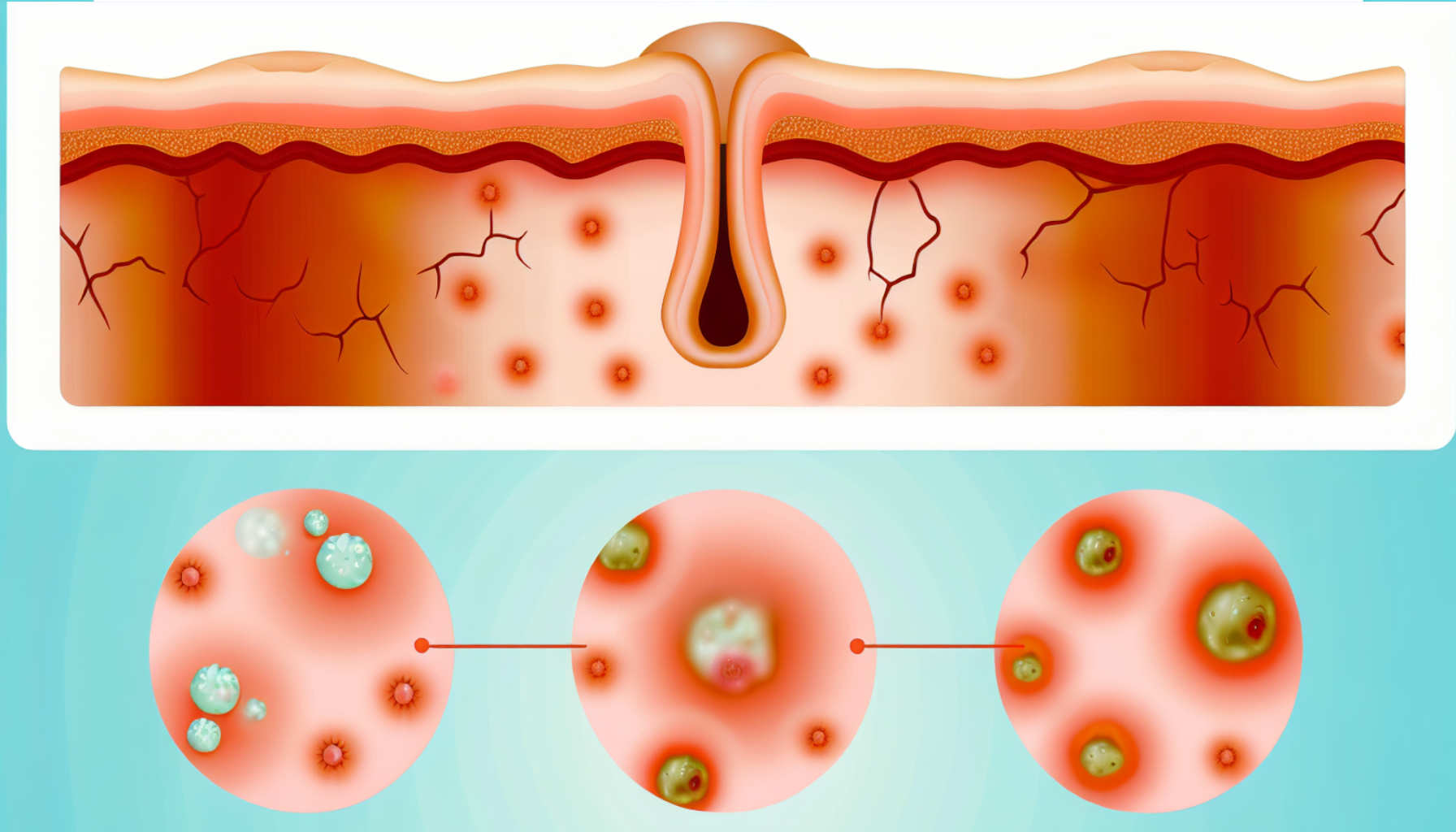 https://homeocare.com.au/wp-content/uploads/2024/06/Abscesses-and-Boils.jpg